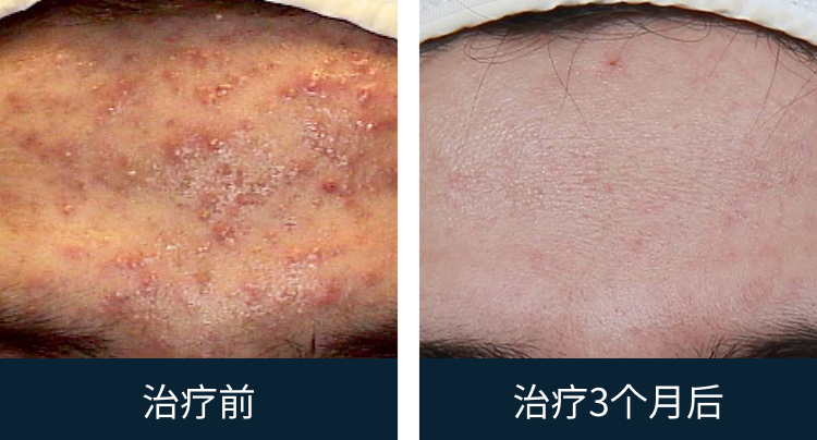 슬라이드 이미지