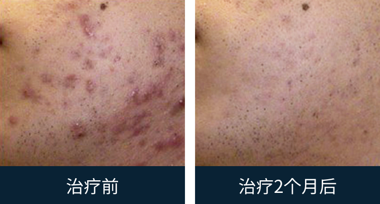 슬라이드 이미지