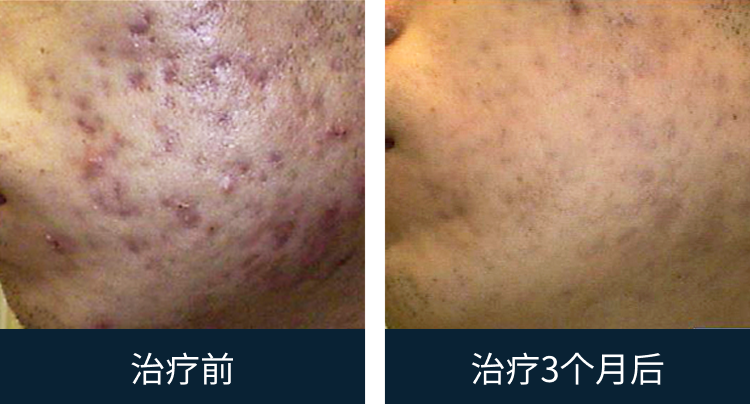 슬라이드 이미지