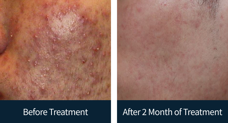 슬라이드 이미지