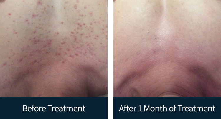 슬라이드 이미지