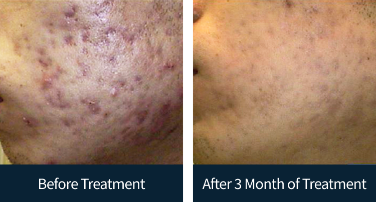 슬라이드 이미지