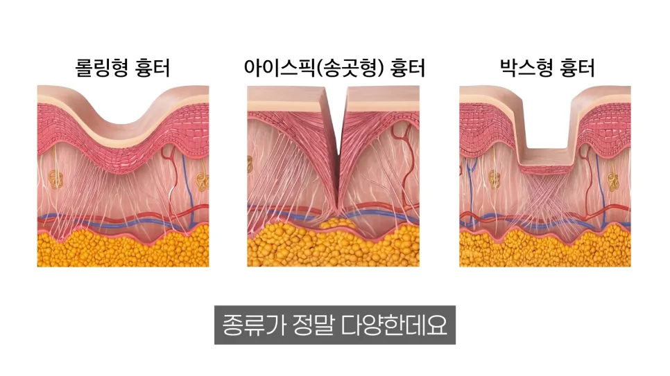 홈케어 자극과 위생 위험