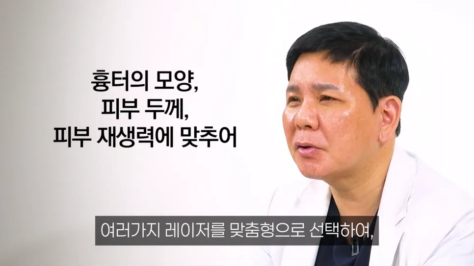 흉터 유형별 접근 필요