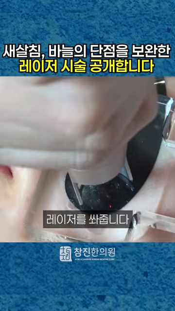 썸네일 이미지